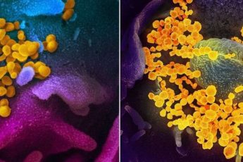 Цифровые фото коронавируса SARS-CoV-2 (желтого цвета) сделанные электронным микроскопом