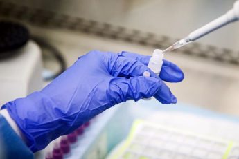Как делают тест на коронавирус в частных лабораториях